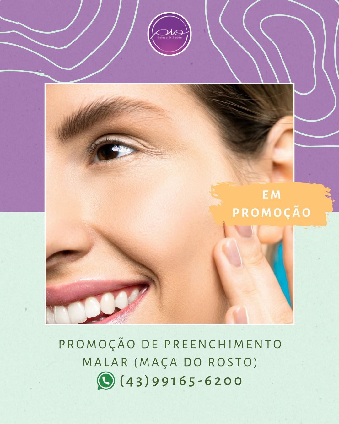 Preenchimento de Malar Bochecha 